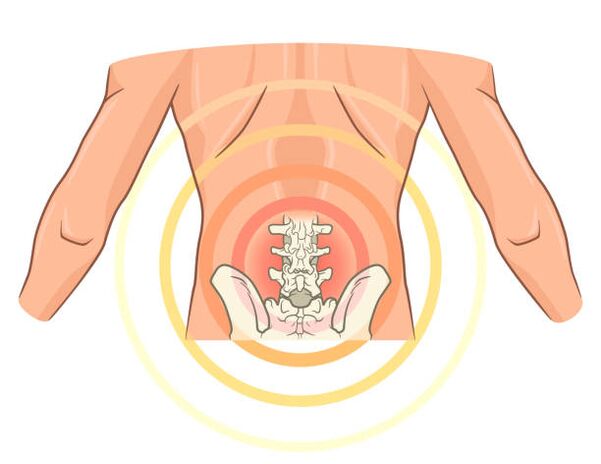 OTSZ Online - Nyaki ideggyöki bántalom, Fájdalomcsillapítók az ágyéki gerinc oszteokondrozisához